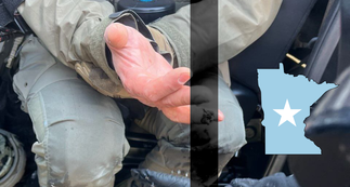 HSI Officer’s Finger Bitten Off by Anti-ICE Rioter in Minneapolis Chaos