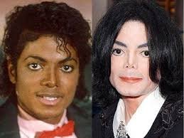 Michael Jackson before and after crazy surgeries
